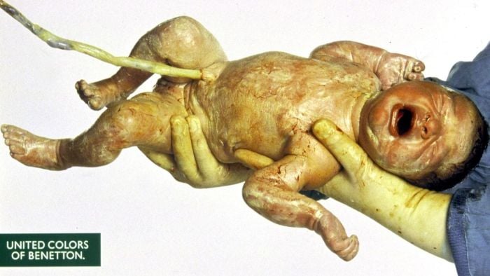 Reklameplakat med en nyfødt, gråtende baby som fortsatt har navlestreng.